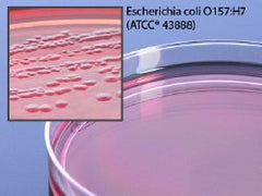 Prepared Media Cefixime Potassium Tellurite Sorbitol-MacConkey Agar (CT-SMAC) Mono-Plate Format PACK OF 10 MK-1003186
