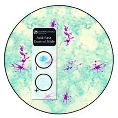 Microbial Identification Control Set Acid Fast Stain Positive Level / Negative Level 10 Slides BOX OF 50 MK-1040504