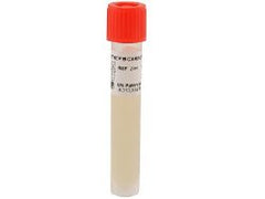 Prepared Media Strep B Carrot Broth™ Tube Format BROTH KIT, STREP B ONE STEP HDX 12X80MM BOX OF 100 MK-1087042