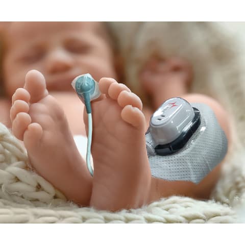 marketlab Guardian Angel® Lite Continuous Pulse Oximeter • Local, GA1001 System • Infant  1 / each