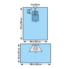 Orthopedic Drape Orthoarts* Shoulder Arthroscopy 172 W X 100 L Inch Sterile  N/S 2PC (12/CS) MK-1222190