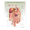 McKesson Anatomical Chart Diseases of the Digestive System, 2nd Edition 20 X 26 Inch Heavy Paper Frame / Hang Laminated MK-1256627