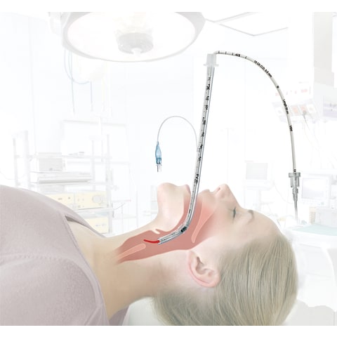 marketlab Malleable Intubating S-Guide  5 / pk