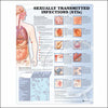 Anatomical Chart Sexually Transmitted Infections (STIS) 20 X 26 Inch Plastic Wall Mount Laminated MK-632305
