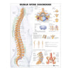 McKesson Anatomical Chart Human Spine Disorders 20 X 26 Inch Plastic Wall Mount Laminated MK-650768