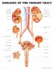 Anatomical Chart Diseases of the Urinary Tract 20 X 26 Inch Plastic Grommets Laminated MK-703208