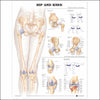 Anatomical Chart Hip and Knee 20 X 26 Inch Plastic Wall Mount Laminated MK-712621