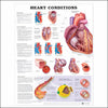 McKesson Anatomical Chart Heart Conditions 20 X 26 Inch Heavy Paper Laminated MK-764733