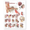 Anatomical Chart Middle Ear Conditions 20 X 26 Inch Paper Grommets Laminated MK-768027