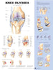 McKesson Anatomical Chart Knee Injuries 20 X 26 Inch Heavy Paper Laminated MK-780723