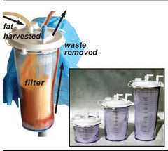 Suction Canister Tissu-Trans® FiltrOn 250 mL Snap-On Lid FILTER SYSTEM, LIPO FILTRON TISSU-TRANS 250CC SHIPRT MK-797972