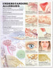 McKesson  Anatomical Chart Allergies 20 X 26 Inch Heavy Paper Grommets Laminated MK-811106