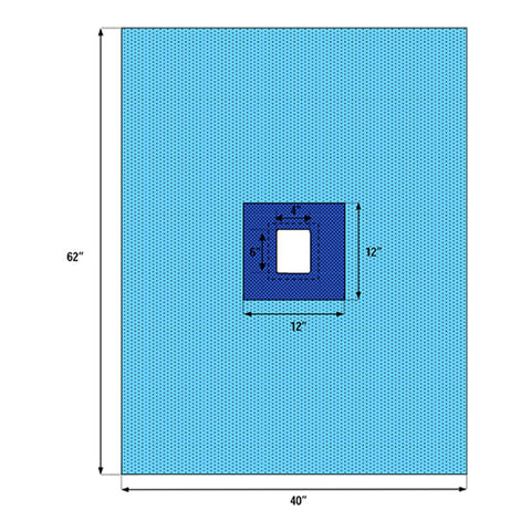 Surgical Drape Fenestrated Drape 40 W X 62 L Inch Sterile  STR BLU 40X60 (60/CS) MK-814167