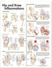 McKesson  Anatomical Chart Hip and Knee 20 X 26 Inch Heavy Paper Grommets Laminated MK-833877