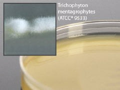 Prepared Media Inhibitory Mold Agar with Chloramphenicol Deep Fill Plate Format BOX OF 5 MK-887024