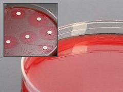 Prepared Media Mueller Hinton Agar with 5% Sheep Blood Plate Format Box of 10 MK-898307