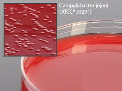 Prepared Media Cefoperazone, Vancomycin, Amphotericin B (Campy CVA) Agar with 5% Sheep Blood Petri Plate Format PACK OF 10 MK-919165