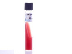 Prepared Media Tryptic Soy Agar (TSA) with 5% Sheep Blood Slant Tube Format PACK OF 20 MK-919195