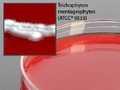 Prepared Media Brain Heart Infusion (BHI) Agar with Blood, Chloramphenicol and Gentamicin Deep Fill Plate Format PACK OF 10 MK-919220