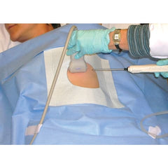 Market lab Ultrasound Sterile Biopsy Drape pack of 25 ML949506