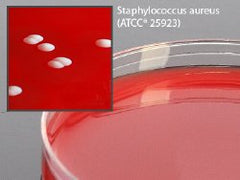 Prepared Media Phenylethyl Alcohol Agar with 5% Sheep Blood Mono-Plate Format PLATES AGAR PEA 10/BX 15X100MM W/5% SHEEP BLOOD D/S Box of 10 MK-975111