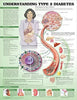 McKesson  Anatomical Chart Type 2 Diabetes 20 X 26 Inch Heavy Paper Grommets Laminated MK-989680