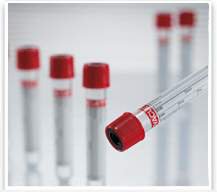 VACUETTE® Z Serum Sep Clot Activator Venous Blood Collection Tube Clot Activator / Separator Gel Additive 4 mL Pull Cap Polyethylene Terephthalate (PET) Tube PK/CS MK-504888