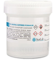 StatLab Medical Products Prefilled Formalin Container StatClick™ Polypropylene 45 mL Fill in 90 mL (3 oz.) Screw Cap Warning Label NonSterile