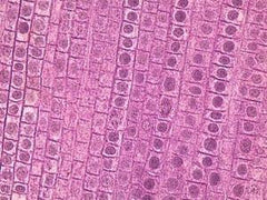 Ward's Science Teaching Microscope Slide Mitosis Fish / Onion 1 X 3 Inch