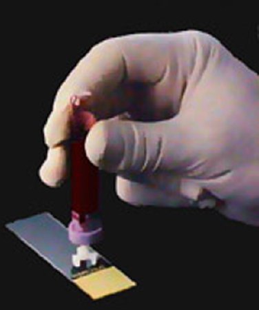 Alpha Scientific Blood Dispenser DIFF-SAFE® 21 Gauge X 1/2 Inch Needle For Blood Smears