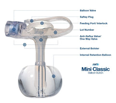 Applied Medical Technologies Balloon Button Gastrostomy Feeding Device AMT MINI Classic 14 Fr. 5 cm Tube Silicone Sterile
