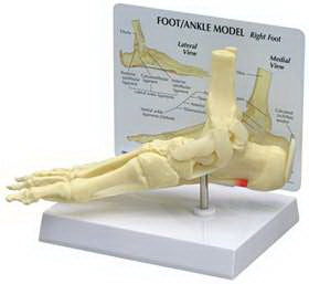 Alimed Foot/Ankle Plantar Fasciitis Model GPI Anatomicals Full Size