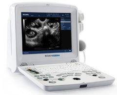 Edan USA Ultrasound System DUS 60 256 Frame Cine Loop Memory, 504 MB Built-In Image Storage, Two USB ports, 7 Types Pseudo Color, 100 to 240 V, 50 to 60 Hz Power Supply
