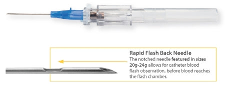 MedSource International Peripheral IV Catheter TrueSafe™ 14 Gauge 1.75 Inch Button Retracting Safety Needle - M-1037276-1889 - Case of 200