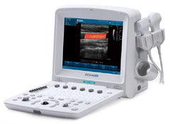 Edan USA Ultrasound System U50 Series 12.1 Inch Display Size, 2 USB Ports, 504 MB Built-In Image Storage, 256 Frames CINE Loop Memory