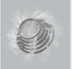Cook Medical Embolization Coil Tornado® - M-1040509-2448 - Each
