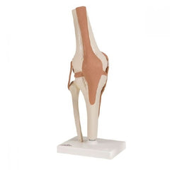 Patterson Medical Supply Anatomical Knee Model FEI