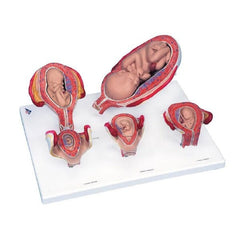 Fabrication Enterprises Pregnancy Series - 5 Models 3B Scientific® 4.63 lbs.