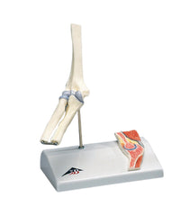 Fabrication Enterprises Mini Elbow with Cross Section of Bone Model 2 lbs.