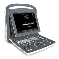 Imaging Associates Ultrasound System Chison 256 Levels Scale, 240 mm Max Depth Scanning, 3 USB ports, 1 Probe Connectors, 8 GB Memory Card, PW Mode