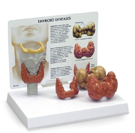 Nasco Thyroid Model Nasco