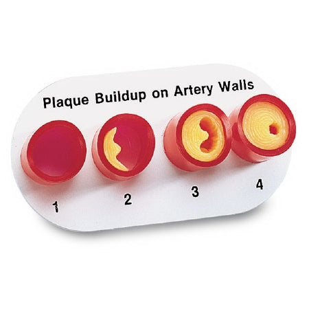 Nasco Artery Sections with Blockage Model