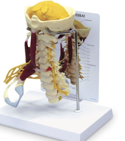 Nasco Life-Size Cervical Model with Muscles and Nerves