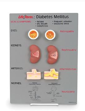 Nasco Diabetes Mellitus Teaching Kit Life/form®