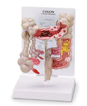 Nasco Colon Model