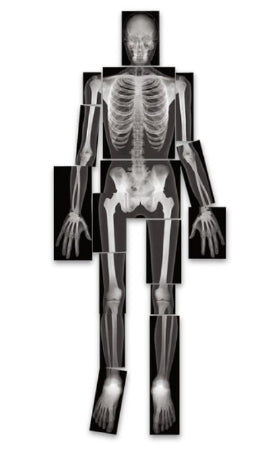 Nasco True-to-Life Human X-Rays™ Roylco®