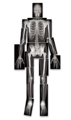 Nasco True-to-Life Human X-Rays™ Roylco®