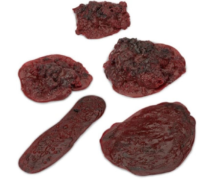 Nasco Clots and Hemorrhages - Set of 5 Life/Form®