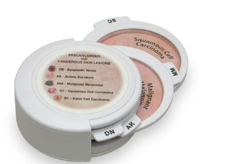 Nasco 5-Piece Hinged Skin Cancer Disk Set GPI Anatomicals®