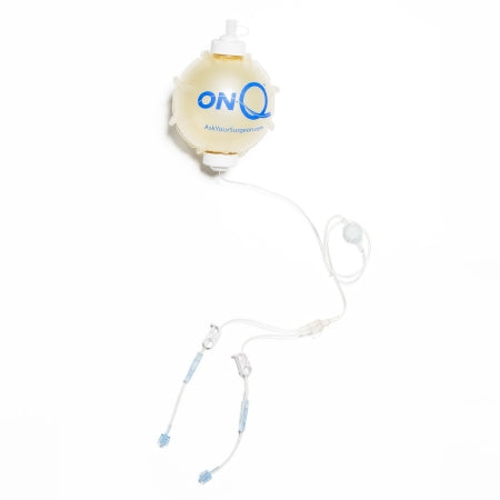 Avanos Medical Sales LLC Pump Kit ON-Q 270 mL Capacity 4 mL / Hr. Flow Rate - M-1083967-2333 - Case of 5